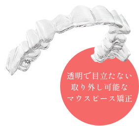 インビザライン